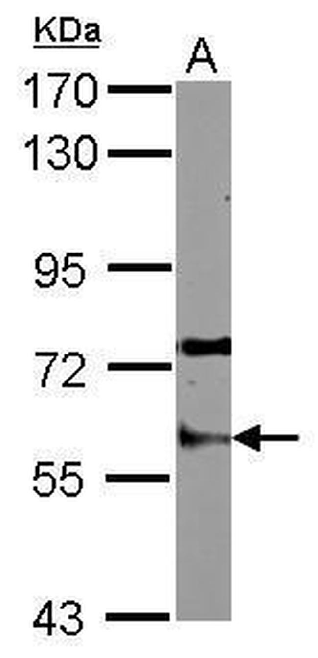Staufen Antibody in Western Blot (WB)