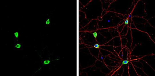 Staufen Antibody in Immunocytochemistry (ICC/IF)