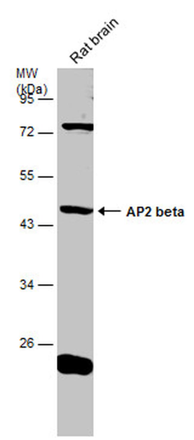 AP2 beta Antibody in Western Blot (WB)