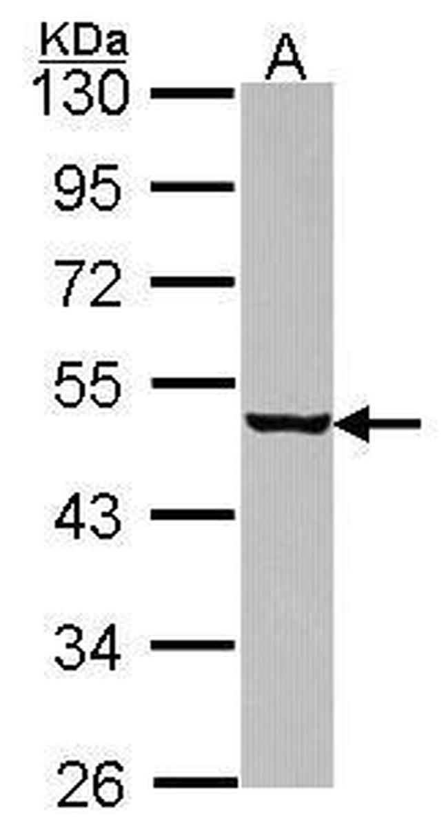 eIF4A1 Antibody in Western Blot (WB)