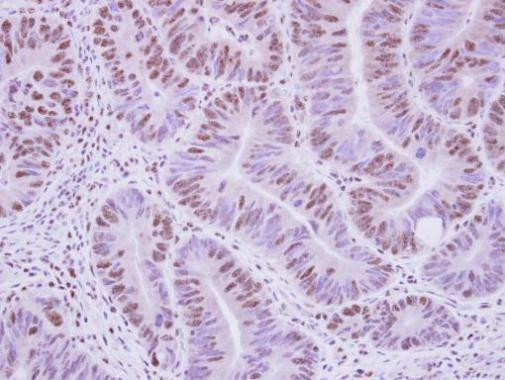 AGFG1 Antibody in Immunohistochemistry (Paraffin) (IHC (P))