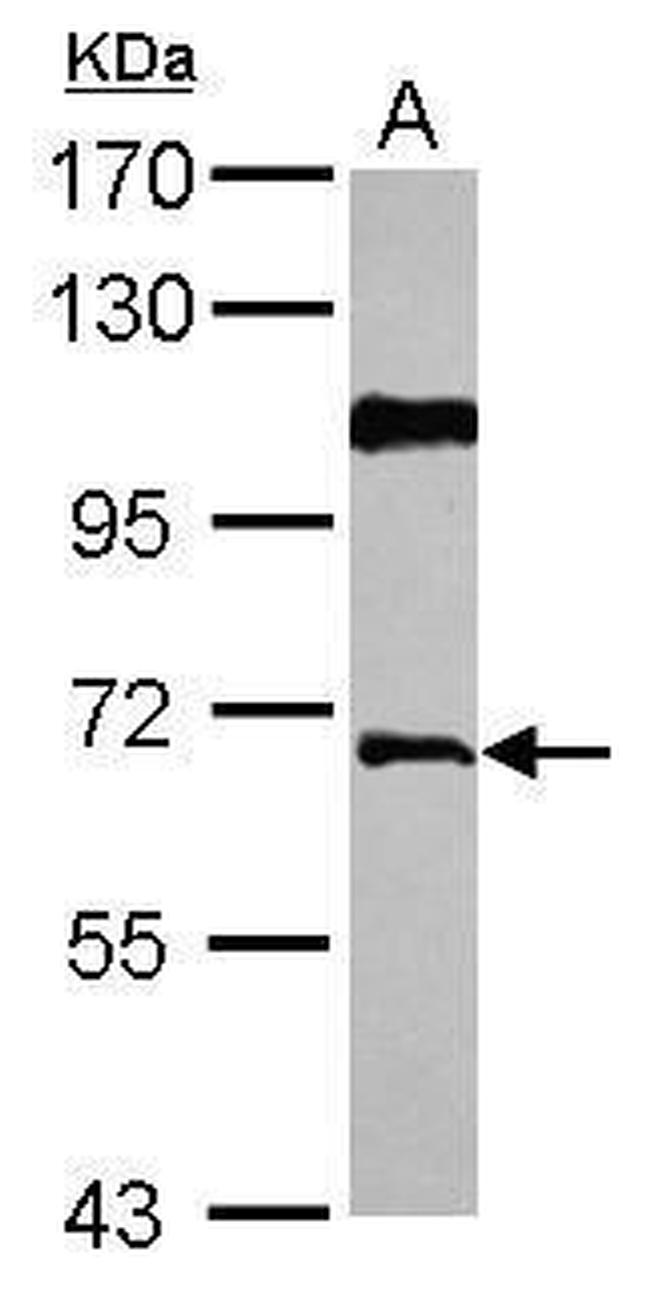 AGFG1 Antibody in Western Blot (WB)