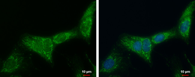 ATP Synthase B1 Antibody in Immunocytochemistry (ICC/IF)