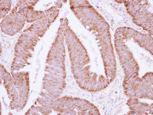 ATP Synthase B1 Antibody in Immunohistochemistry (Paraffin) (IHC (P))