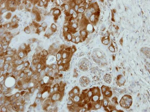 CNOT3 Antibody in Immunohistochemistry (Paraffin) (IHC (P))