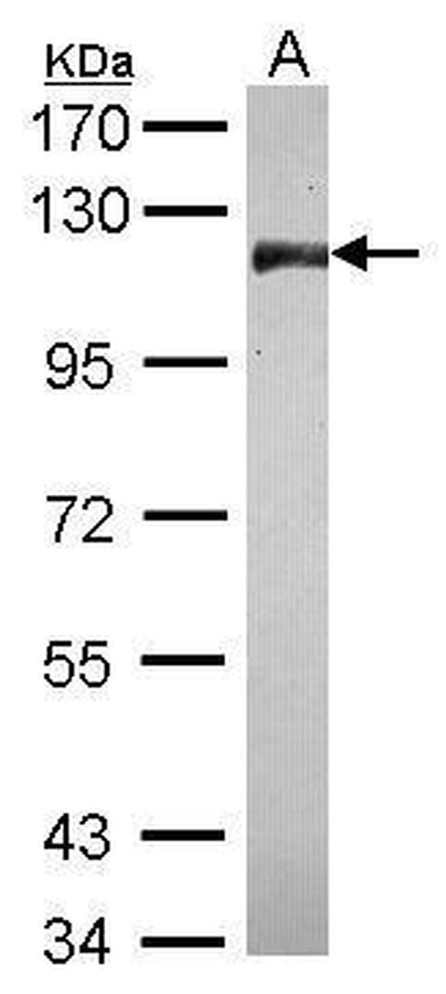 CNOT3 Antibody in Western Blot (WB)