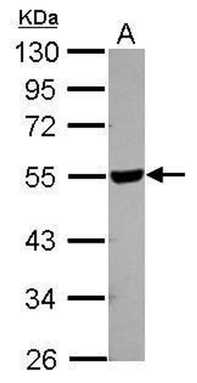 HYAL2 Antibody in Western Blot (WB)