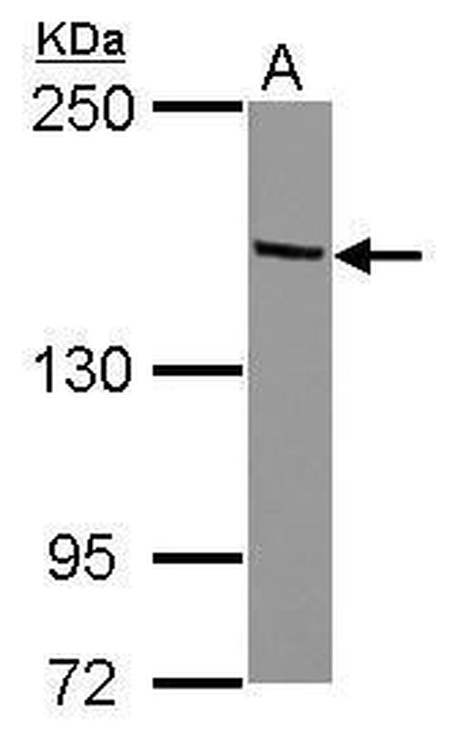 TRIM24 Antibody in Western Blot (WB)