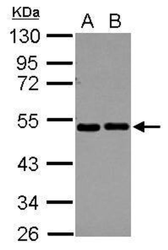 eIF2 beta Antibody in Western Blot (WB)