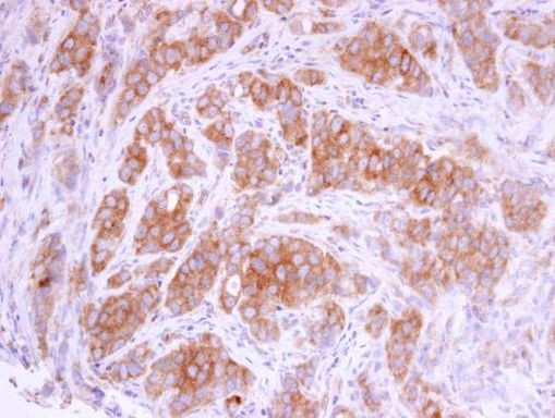 EMAP II Antibody in Immunohistochemistry (Paraffin) (IHC (P))