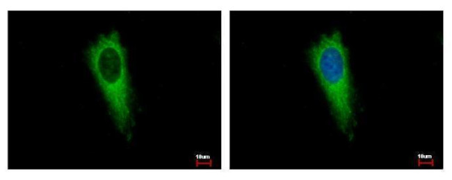 EMAP II Antibody in Immunocytochemistry (ICC/IF)