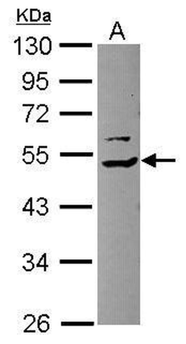 TRIP15 Antibody in Western Blot (WB)