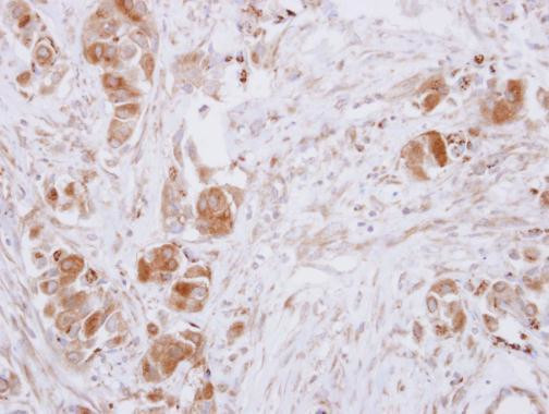 GDA Antibody in Immunohistochemistry (Paraffin) (IHC (P))