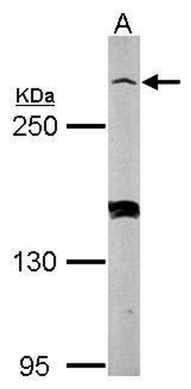 Myomegalin Antibody in Western Blot (WB)