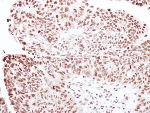 RNF40 Antibody in Immunohistochemistry (Paraffin) (IHC (P))