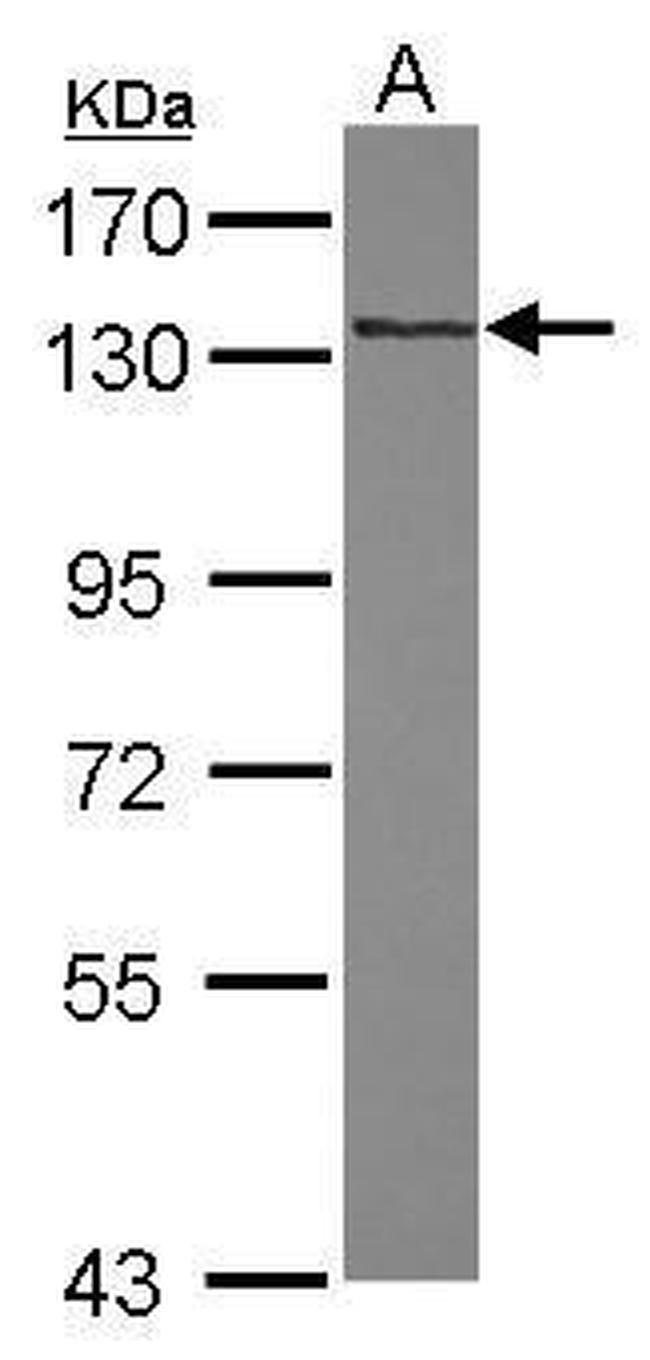 RNF40 Antibody in Western Blot (WB)