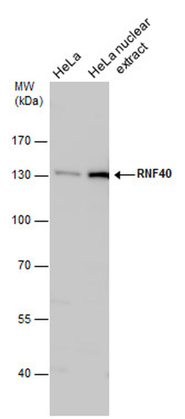 RNF40 Antibody in Western Blot (WB)