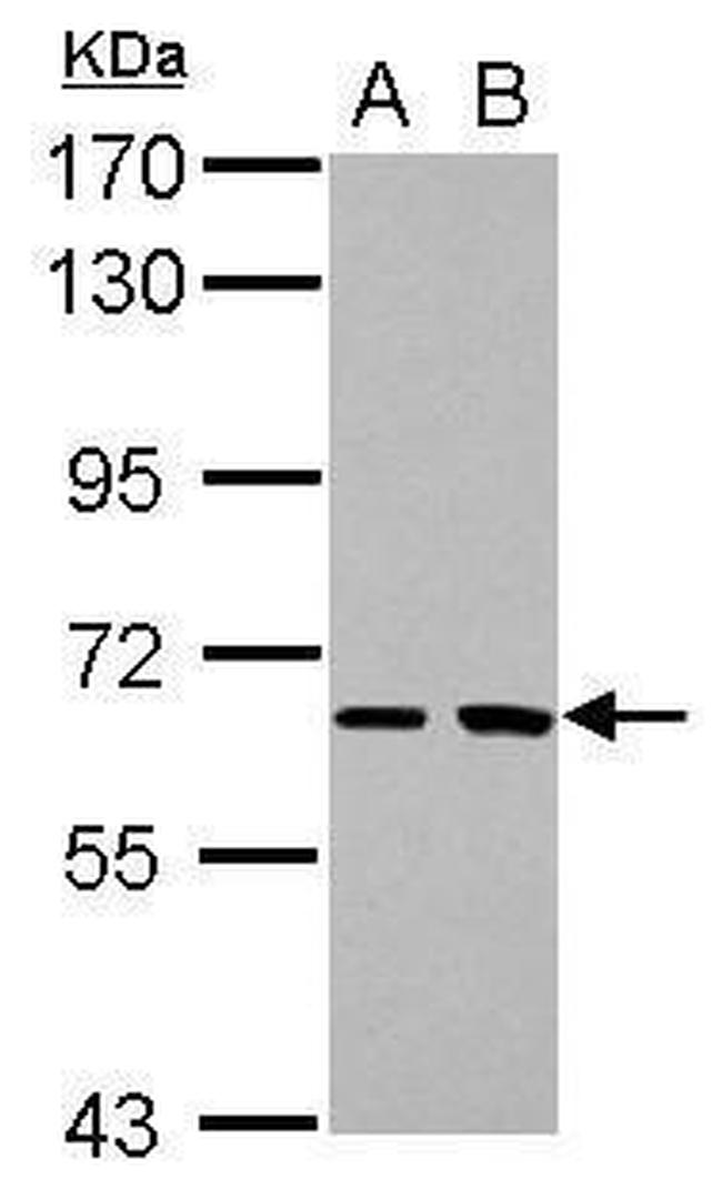 SH2D3A Antibody in Western Blot (WB)