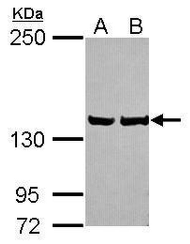 LRP130 Antibody in Western Blot (WB)