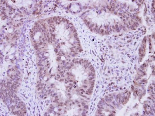 Vinexin Antibody in Immunohistochemistry (Paraffin) (IHC (P))