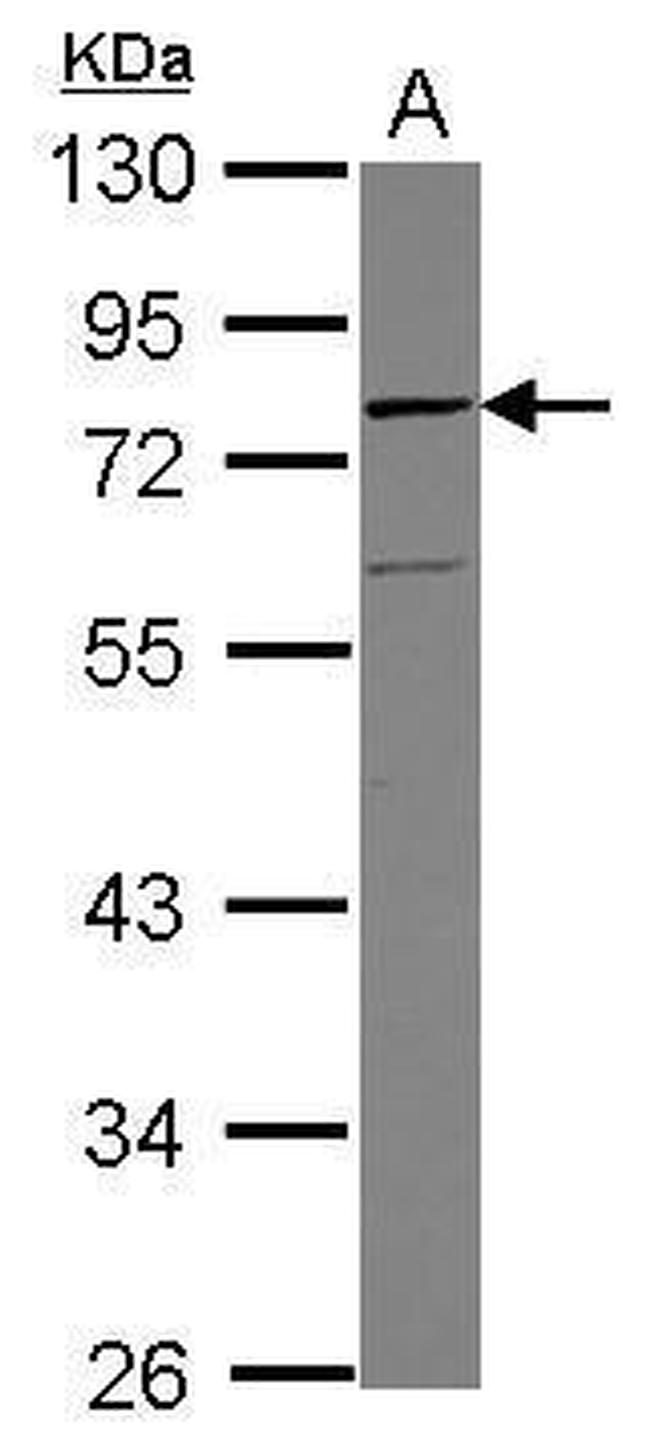 Vinexin Antibody in Western Blot (WB)