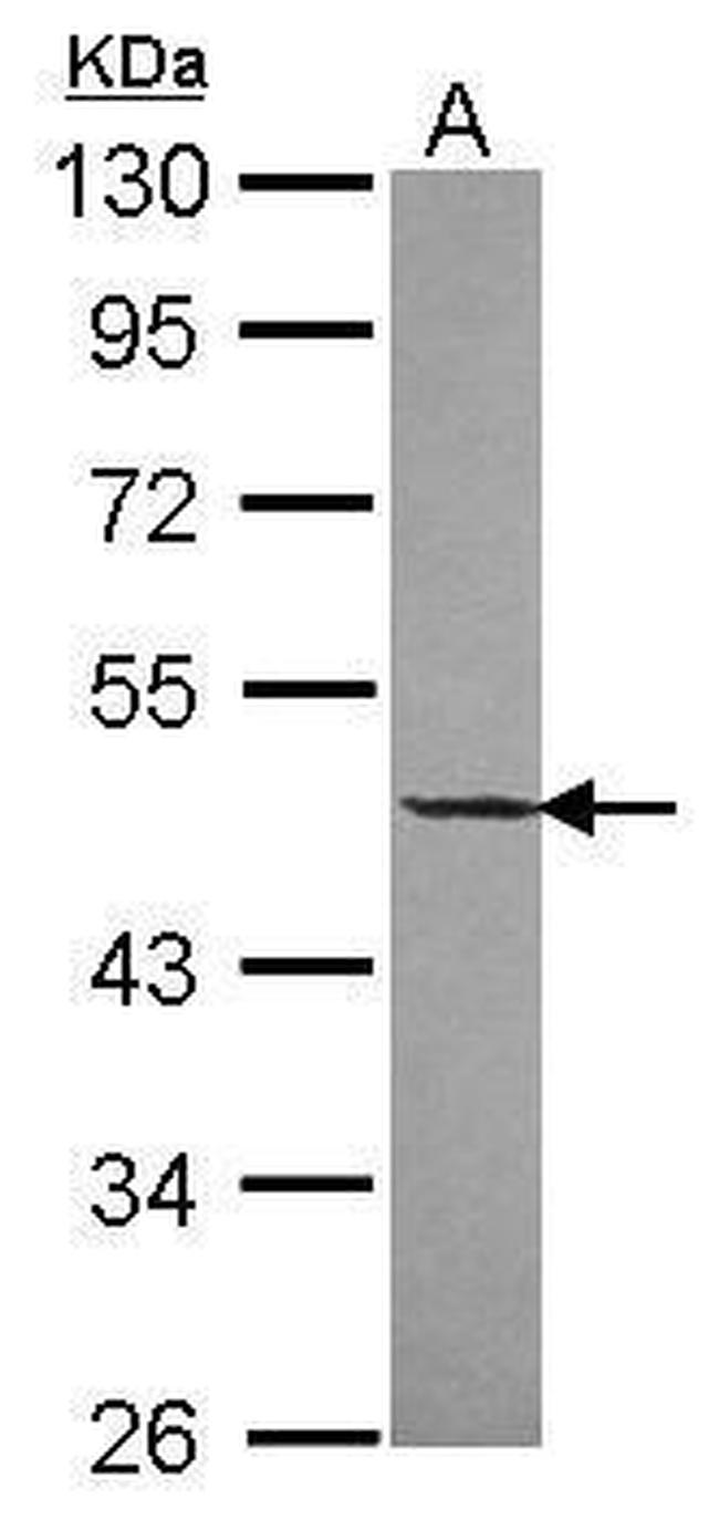 DNAJA2 Antibody in Western Blot (WB)