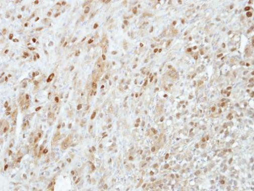 PRMT5 Antibody in Immunohistochemistry (Paraffin) (IHC (P))