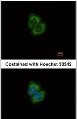 CaMKK beta Antibody in Immunocytochemistry (ICC/IF)