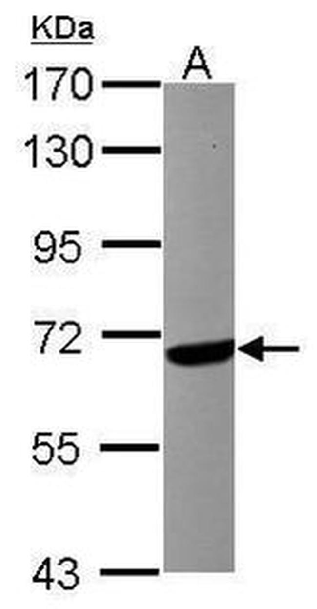 CaMKK beta Antibody in Western Blot (WB)