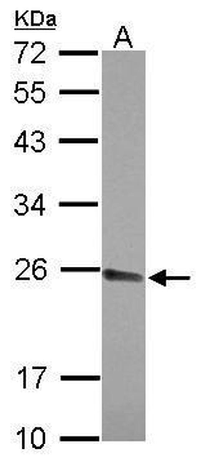 CPSF4 Antibody in Western Blot (WB)