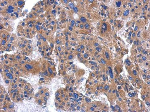 AP3M2 Antibody in Immunohistochemistry (Paraffin) (IHC (P))