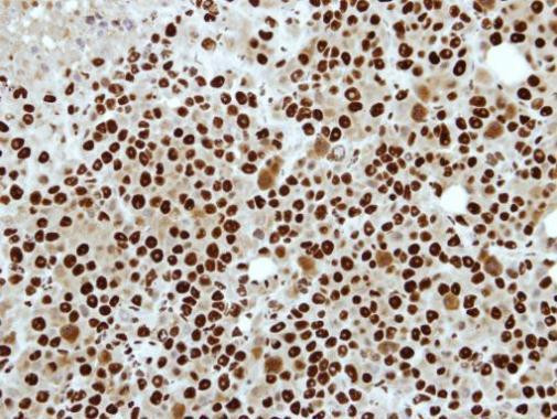 RbAp48 Antibody in Immunohistochemistry (Paraffin) (IHC (P))