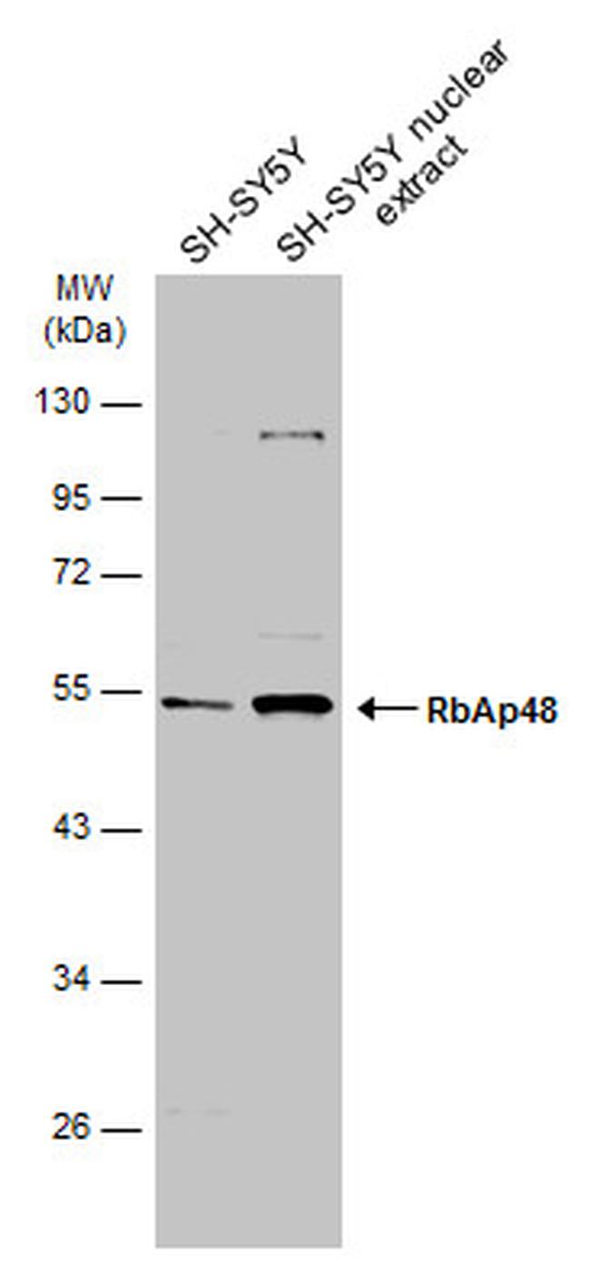 RbAp48 Antibody in Western Blot (WB)