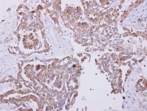 HSPE1 Antibody in Immunohistochemistry (Paraffin) (IHC (P))