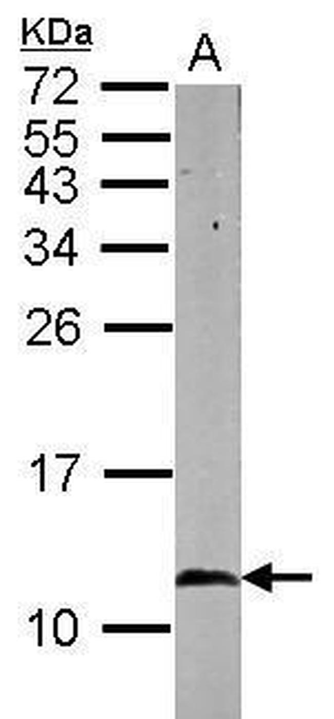 HSPE1 Antibody in Western Blot (WB)