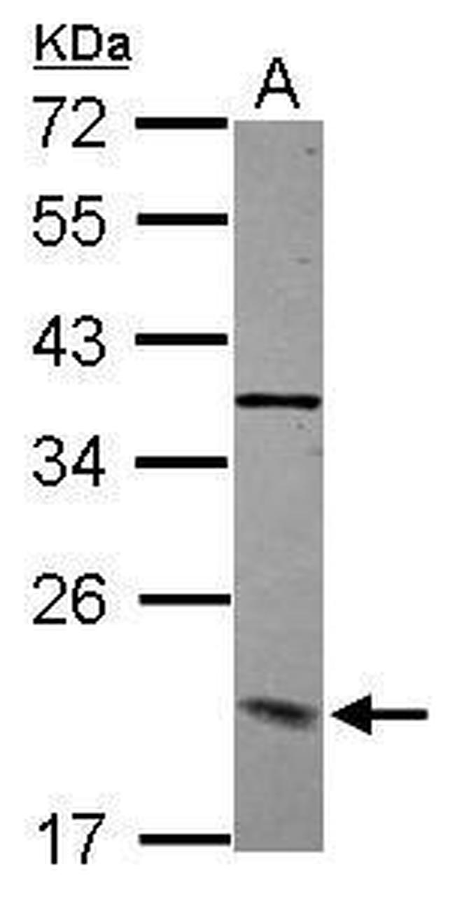 Dynactin 3 Antibody in Western Blot (WB)