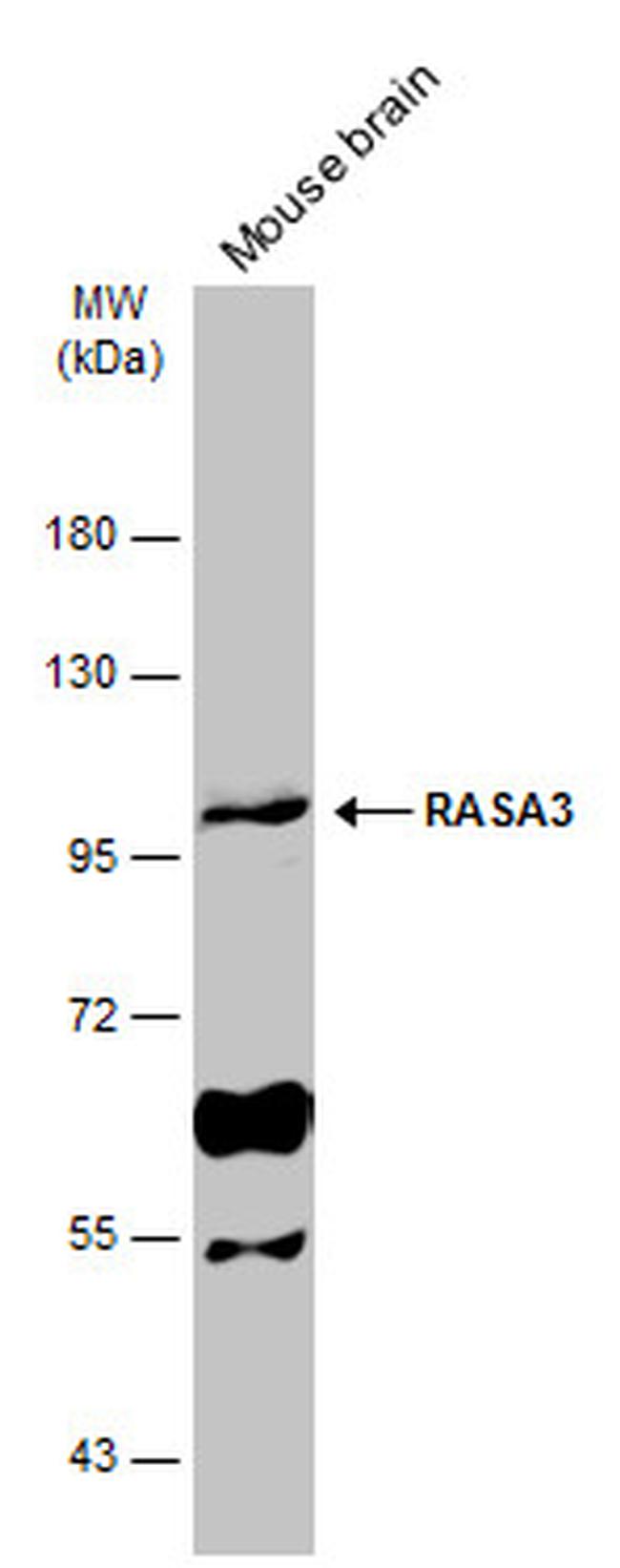 RASA3 Antibody in Western Blot (WB)