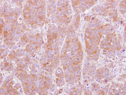 NT5C2 Antibody in Immunohistochemistry (Paraffin) (IHC (P))