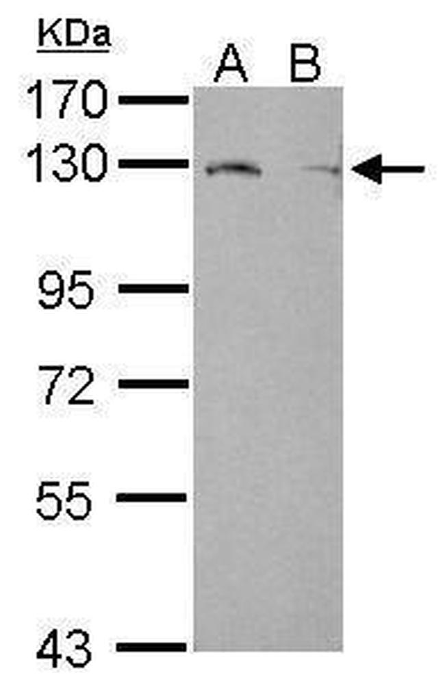 LPIN1 Antibody in Western Blot (WB)