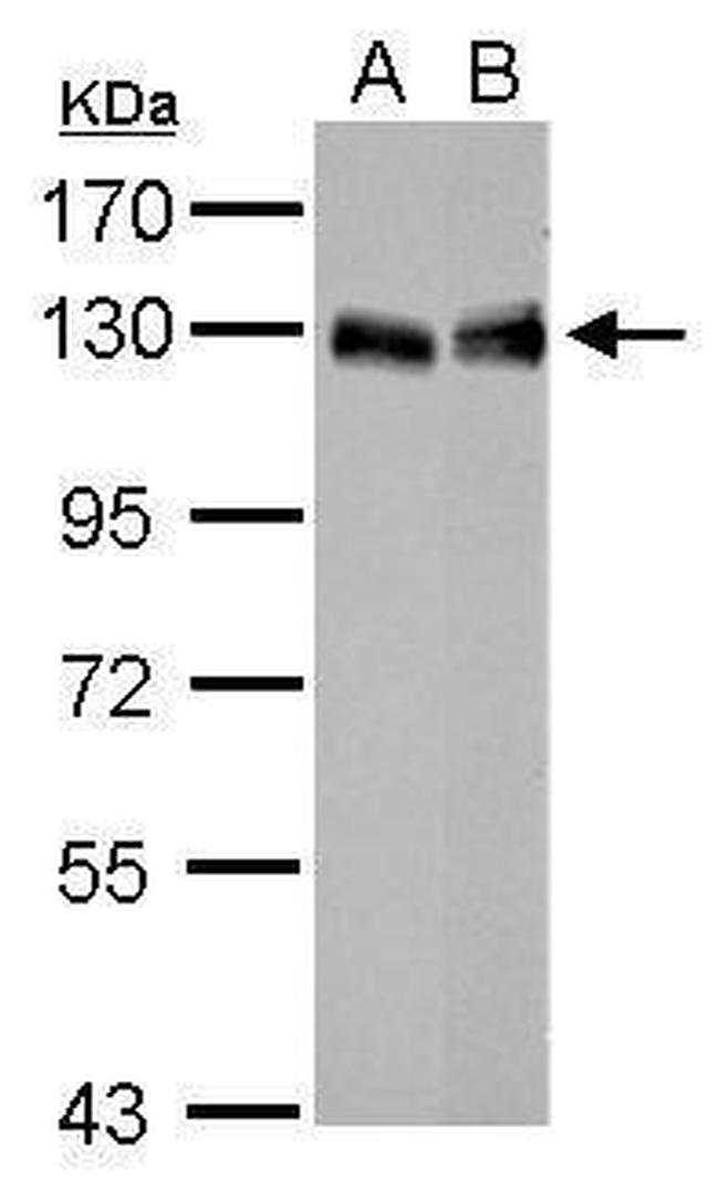 LPIN1 Antibody in Western Blot (WB)