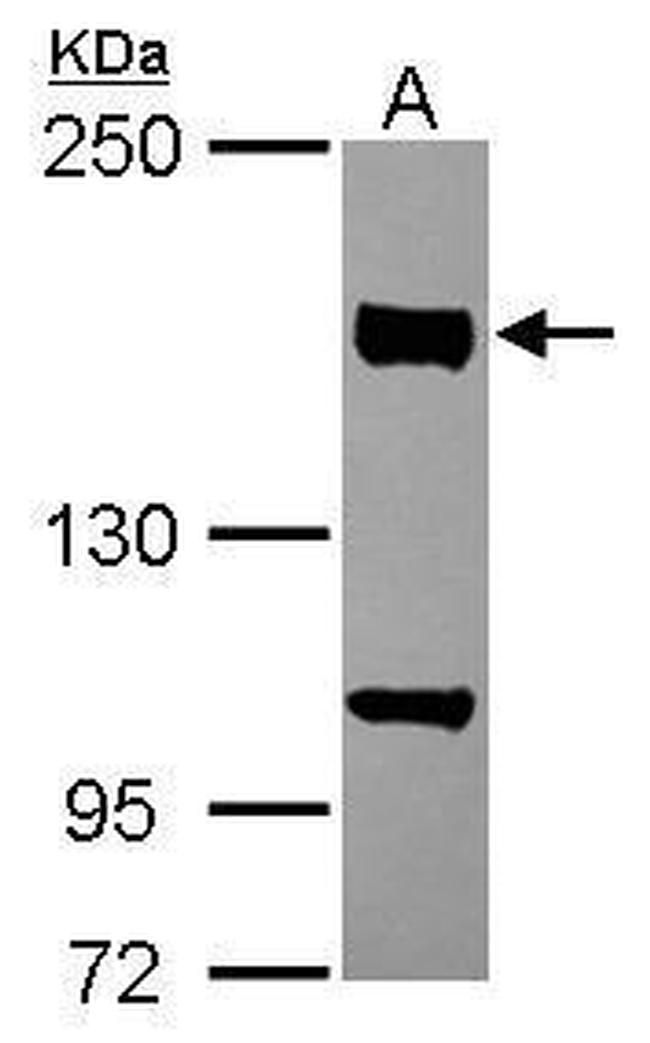 CLASP1 Antibody in Western Blot (WB)