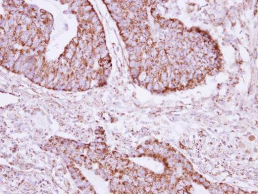 ACOT9 Antibody in Immunohistochemistry (Paraffin) (IHC (P))