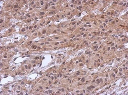 MKRN2 Antibody in Immunohistochemistry (Paraffin) (IHC (P))