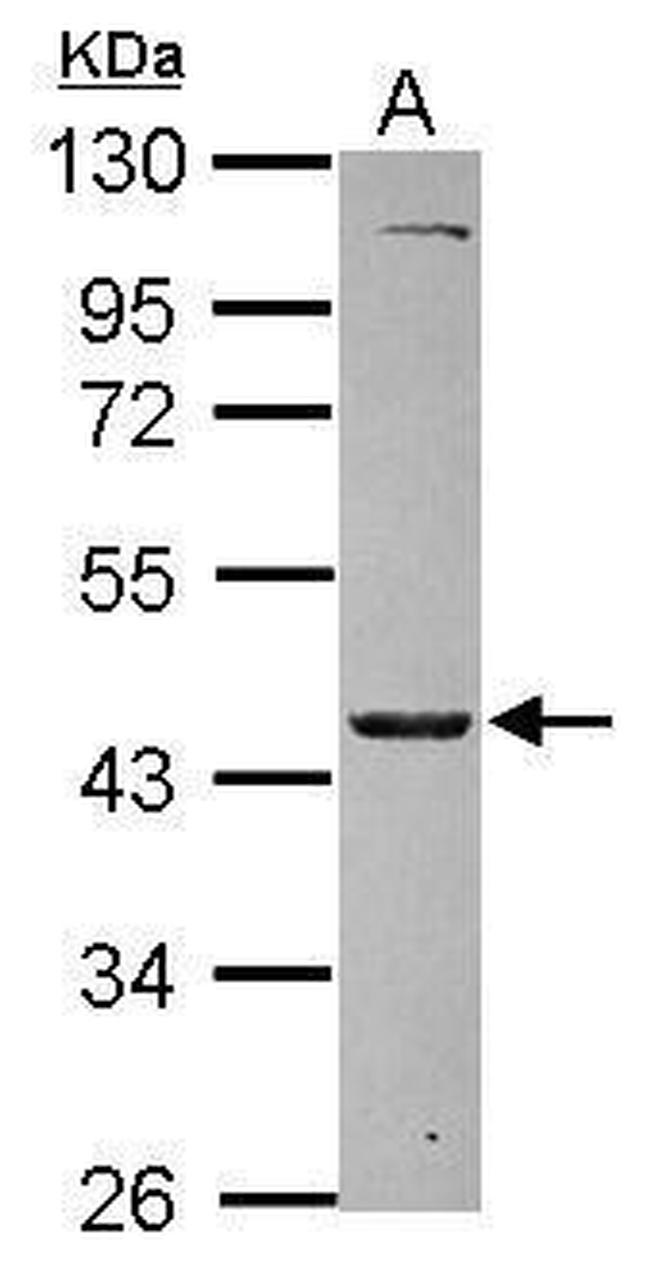 MKRN2 Antibody in Western Blot (WB)