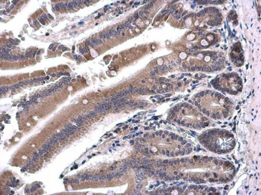 SH3BP1 Antibody in Immunohistochemistry (Paraffin) (IHC (P))