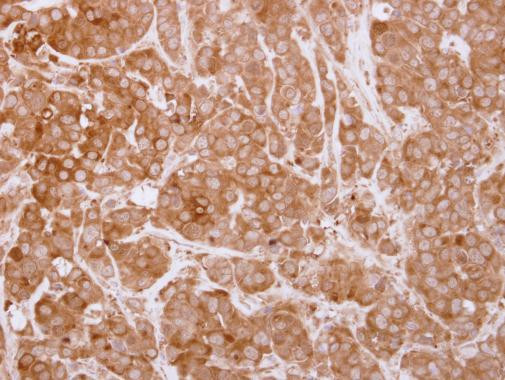 SH3BP1 Antibody in Immunohistochemistry (Paraffin) (IHC (P))