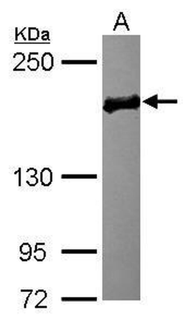 EDC4 Antibody in Western Blot (WB)