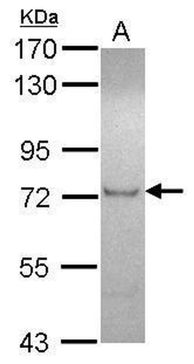 ZFP95 Antibody in Western Blot (WB)