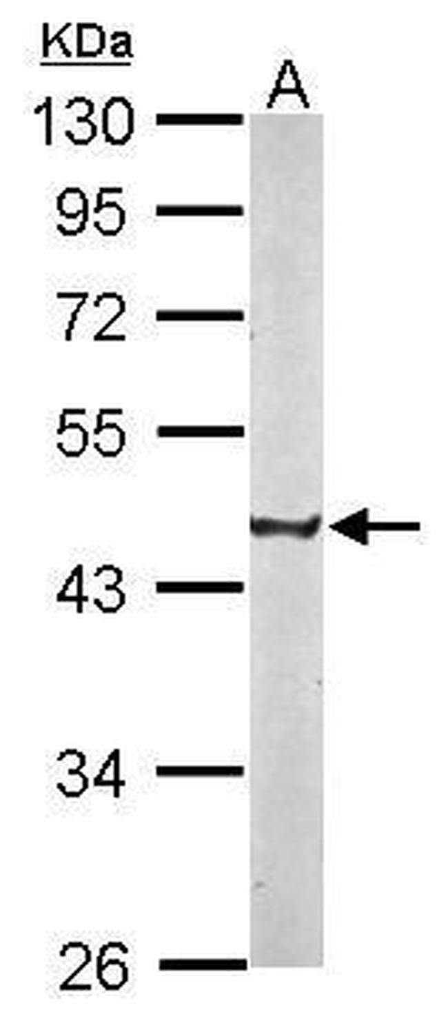 CREST Antibody in Western Blot (WB)
