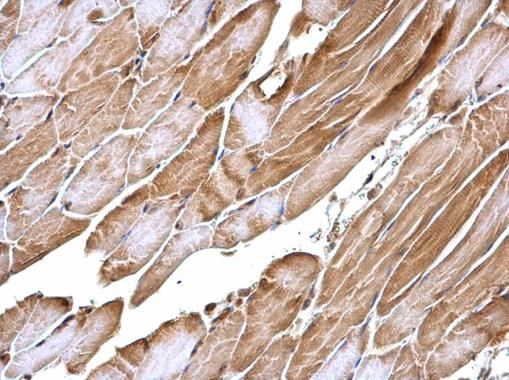 APPL1 Antibody in Immunohistochemistry (Paraffin) (IHC (P))